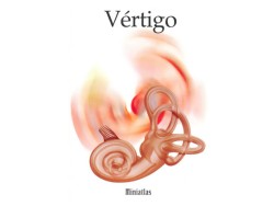Vértigo